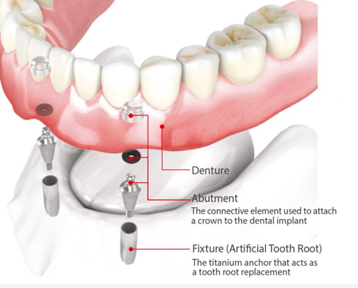 full-set-of-teeth-diagram-1