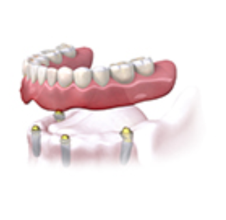full-set-of-teeth-diagram-2